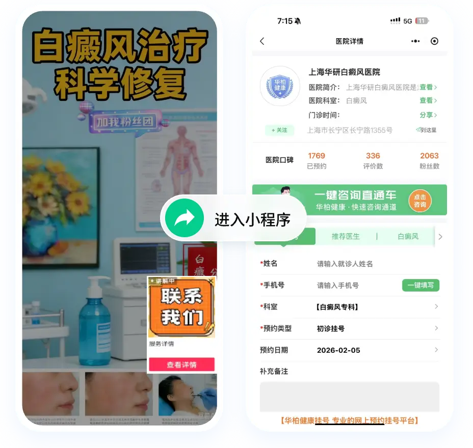 某治疗白癜风医院